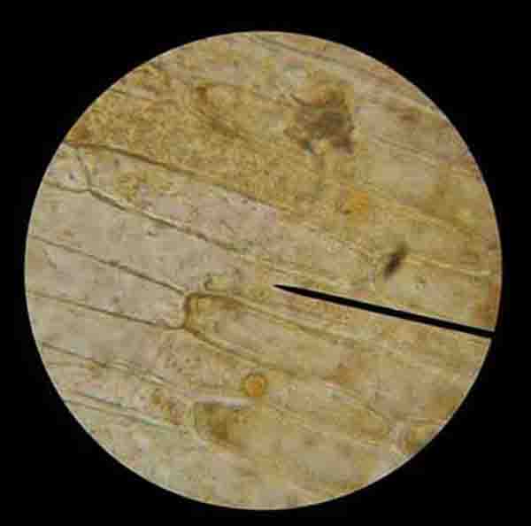 Onion Epidermal Cells Stained With Iodine 400xTM