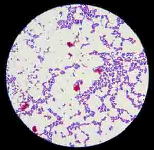 endospore stain