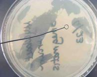 Inoculation loop over Petri dish of cooled, solid  TSY agar.
