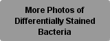 More Photos of Differentially Stained Bacteria Button