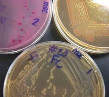 These are three plates of MacConkey's agar. Each plate has a different organism growing on it. What does the media tell you about each of these unknown bacteria?