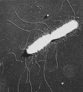 Electron micrograph of Salmonella bacteria showing both flagella (long extensions) and fimbriae (short extensions).