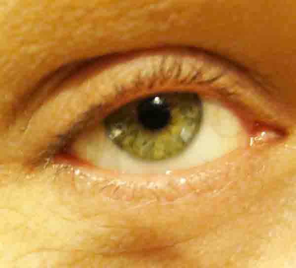 Green Eyes, a Recessive Trait