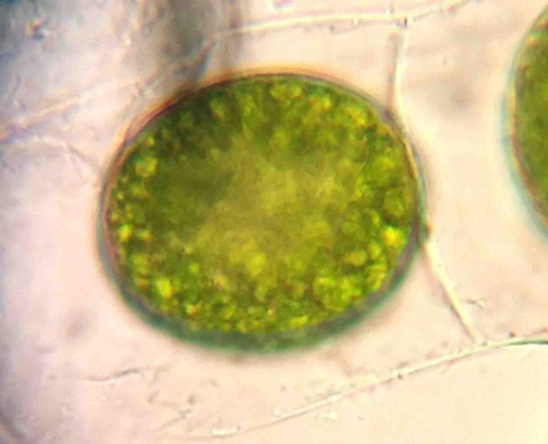 Green algae from freshwater pond in Kalamazoo, MI