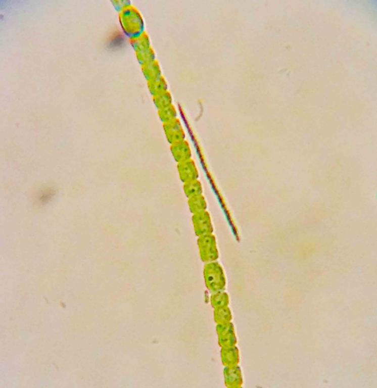 Anabaena blue green algae pond life.