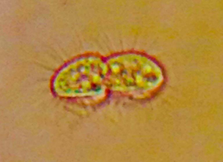 Cyclidium,  a freshwater protozoan ciliate.