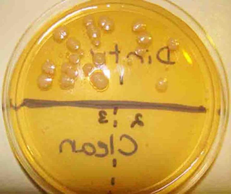 TSY Agar with sample from dirty dishwasher and clean dishwasher.