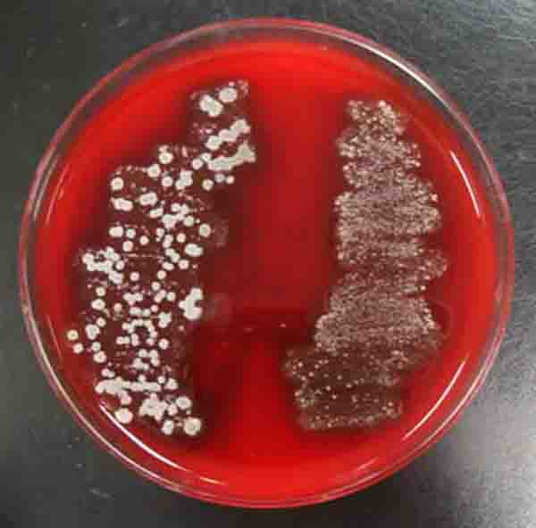 Bacterial colonies growing on the surface of Blood Agar.