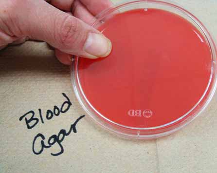 Sterile Blood Agar Plate