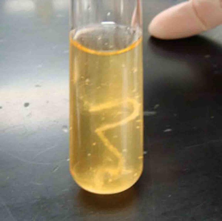 Liquid Broth Medium with Bacterial Growth