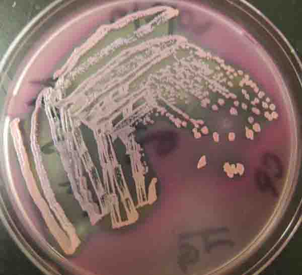 Lactose Fermenting Gram-negative Bacteria Growing on MacConkey's Agar