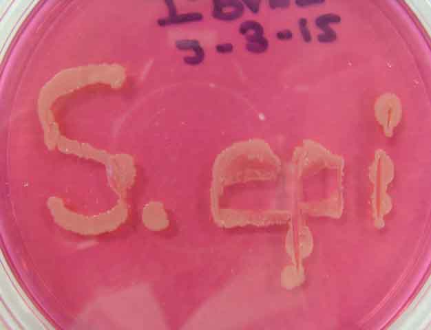Mannitol Salts Agar (MSA) growing Staphylococcus epidermidis. 