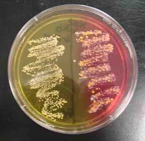 MSA growing mannitol fermenting pathogenic halophile S. aureus on left and S. epi on right 