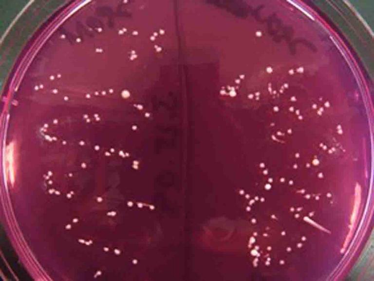 Tiny punctiform colonies of Staphylococcus epidermidis growing on Mannitol Salt Agar.