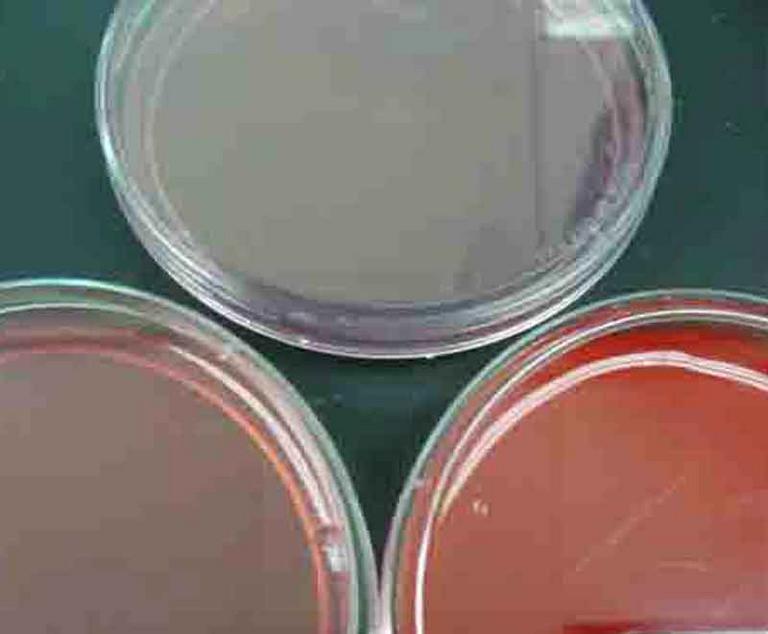 Specialized Bacterial Growth Media: Mannitol Salt, MacConkeys & Blood Agar (clockwise from left)