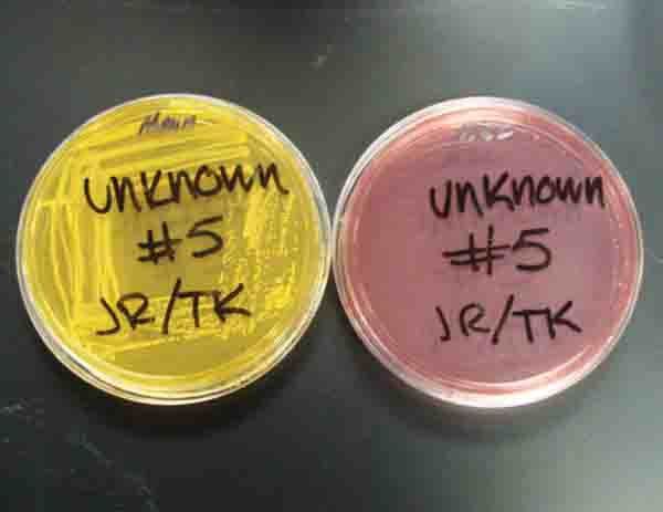Photo of an unknown bacteria plated on Mannitol Salt Agar and MacConkeys Agar 