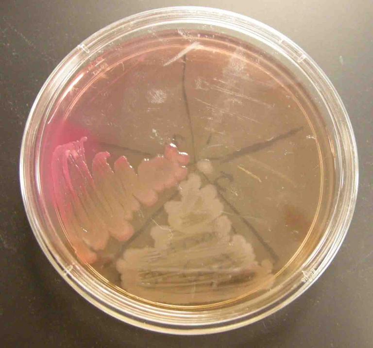 MacConkey's Agar inoculated with the following control samples (clockwise from top left): Staph aureus, Staph epi, sterile loop, Salmonella, E. coli.