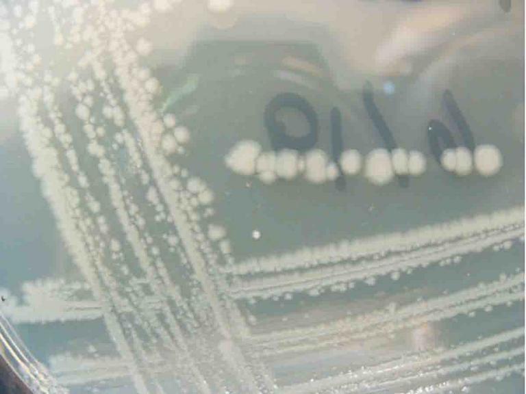 Close up of E. coli colonies on a streak plate of TSY agar.