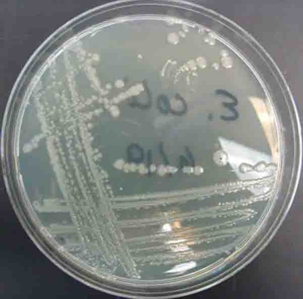 Isolation streak plate of E. coli on TSY agar