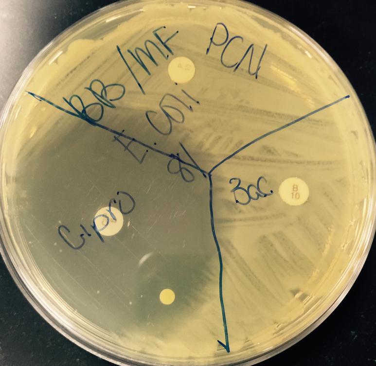 TSY agar inoculated with Escherichia coli,  a Gram-negative  bacterium. Three antibiotic sensitivity disks appear on this plate: penicillin, bacitracin and ciprofloxacin (clockwise from top).