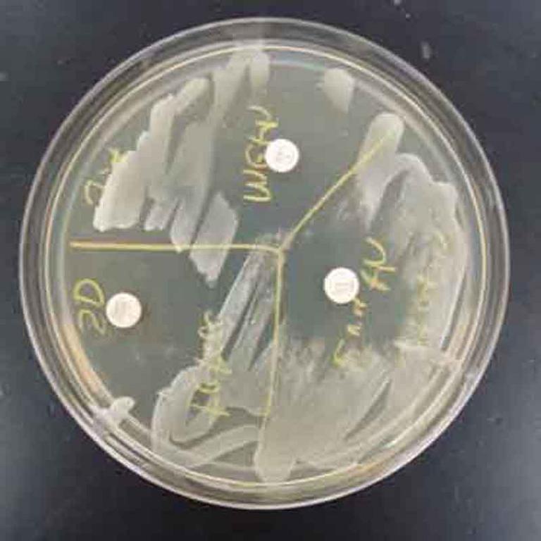 TSY Plate With Bacterial Growth and Zones of Inhibition from Anitbiotic Disks