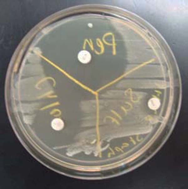 TSY agar inoculated with Staphylococcus. Three antibiotic sensitivity disks appear on this medium: penicillin, sulfa, and ciprofloxacin (clockwise from top). Note the "zone of inhibition" around each antibiotic disk. The larger the zone of bacterial inhibition, the more effective the antibiotic is against the bacteria.