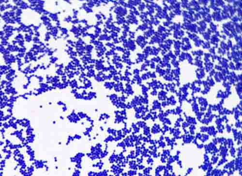 staphylococcus epidermidis endospore stain