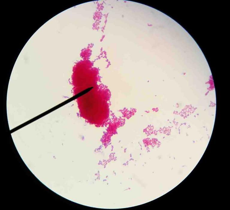 Acid Fast Stain Free Microbiology Images From Science Prof Online