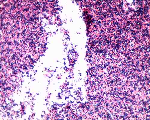 micrococcus luteus gram stain