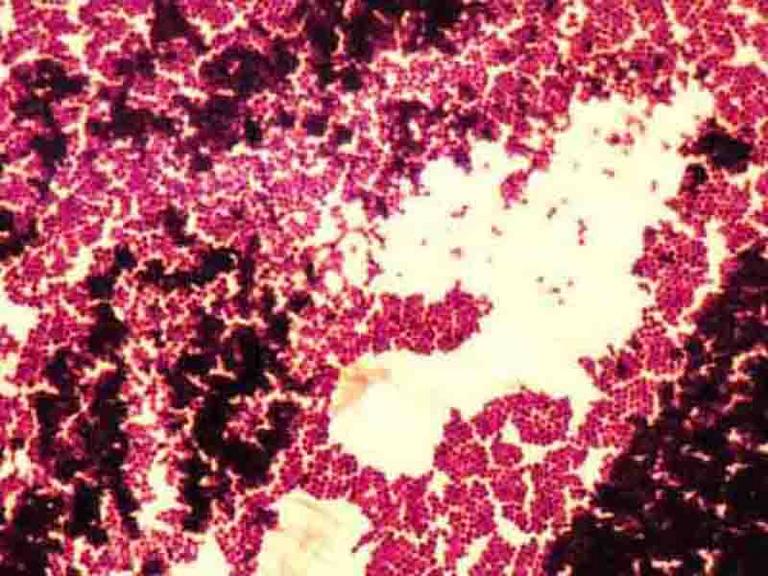 Staphylococcus epidermidis 400x, A slide of gram-stained St…