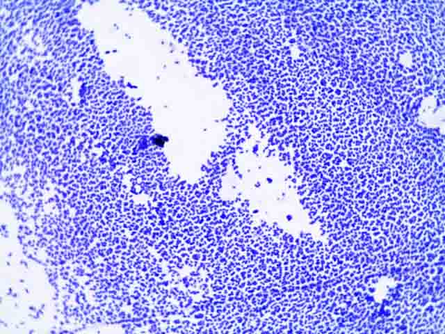 Bacterial Staining Microbiology Images Photographs And Videos Of Gram Acid Fast Endospore