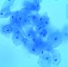 Human Cheek Epithilial Cells Stained With Methylene Blue 400xTM