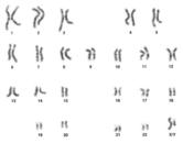Karyotype of Human Male