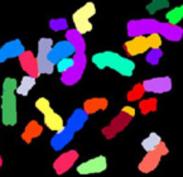 Color-coded Chromosomes, Institut of Human Genetics