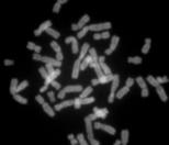 Metaphase chromosomes from a female human lymphocyte, stained with Chromomycin A3
