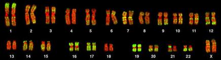 Karyotype of a human female, showing 22, duplicated, homologous pairs of autosomes, and two duplicated X chromosomes.