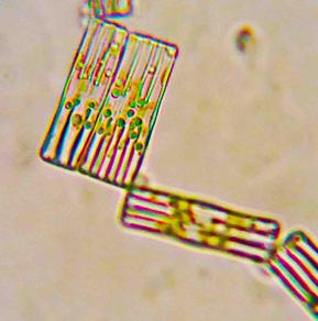 Tabellaria Diatom Algae from Freshwater Pond
