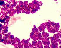 Gram Positive Stained Staphylococcus Bacteria @ 1000xTM