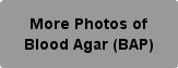 More Photos of Blood Agar (BAP) Button