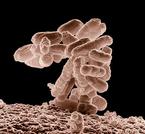E. coli Coliform Bacteria Magnified @10,000xTM