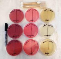 Equipment used for Shark PRO Steam & Spray Mop Sanitation Experiment:  -sterile swabs -3 TSY agar plates -3 MacConkey's agar plates 3 Mannitol Salt agar plates - permanent marker