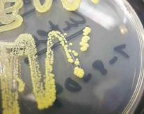 Micrococcus luteus pure culture isolated from arm plate clinical sample pictured above.​