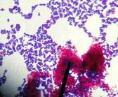 Acid-fast stain showing both positive (Mycobacteria) and negative (Staphylococcus) @1000xTM