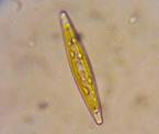 Cymbellum diatom algae​ pond life.