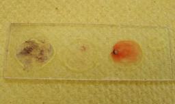 Gram stained slide, showing + & - bacterial controls on left and right circles of slide and unknown bacteria in center.