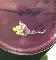 Example of Colony Morphology of Bacteria Grown onMacConkey's