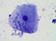Cheek Cell (eukaryotic) and Oral Bacteria (prokaryotes) @ 400xTM