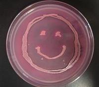 E. coli Growing on MacConkey's Medium, T. Port