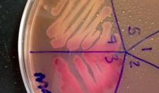 MacConkey's Agar with Lac- Salmonella on top and Lac+ Ecoli on bottom