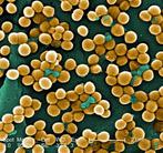 Staphylococcus aureus by Janice Haney Carr